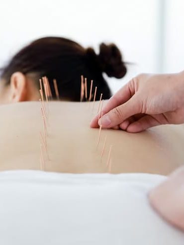 WhatsApp Image 2026-06-15 at 11.44.32 PM (1) ACUPUNCTURE